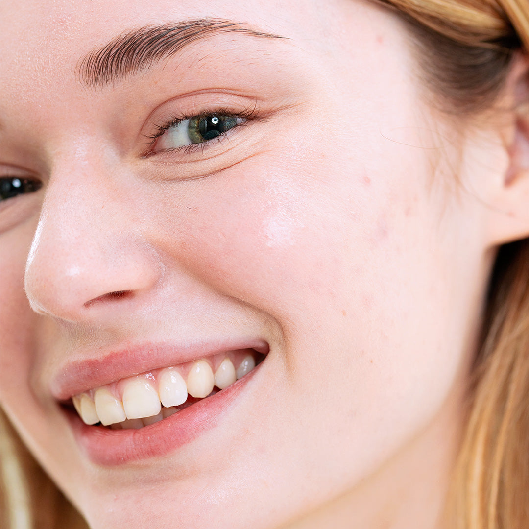 Close-up of a smiling woman with fair skin showing a natural, clear complexion with subtle texture.
